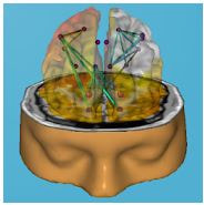 Brain Neurolink Q